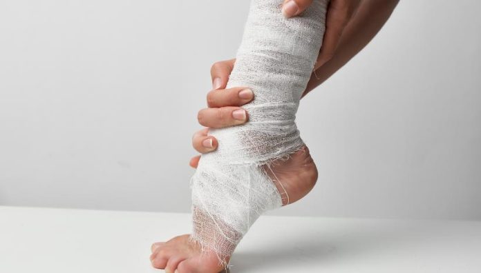 Processing Leg Injury Compensation Claims