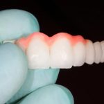 Bridges and Dentures