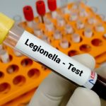 Legionella Control – Your Legal Responsibility as a UK Business Owner