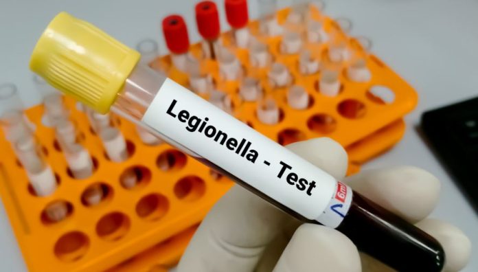 Legionella Control - Your Legal Responsibility as a UK Business Owner Legionella Control - Your Legal Responsibility as a UK Business Owner