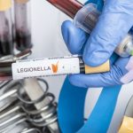 What Is Legionella and Why Is It Dangerous