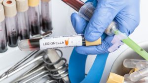What Is Legionella and Why Is It Dangerous?
